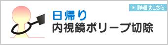 日帰り内視鏡ポリープ切除