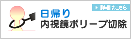 日帰り内視鏡ポリープ切除